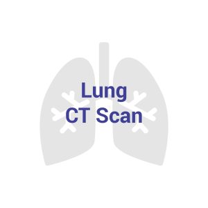 Lung CT Scan (CT Thorax)