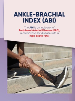 1 session Ankle-Brachial Test (ABI) Test