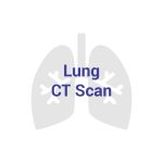 Lung CT Scan (CT Thorax)