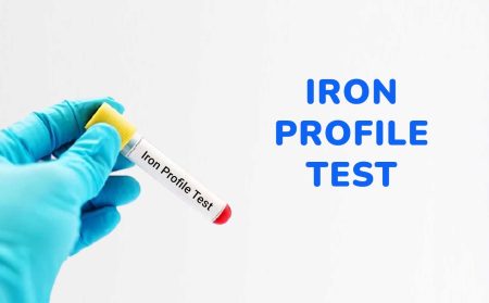 iron profile test