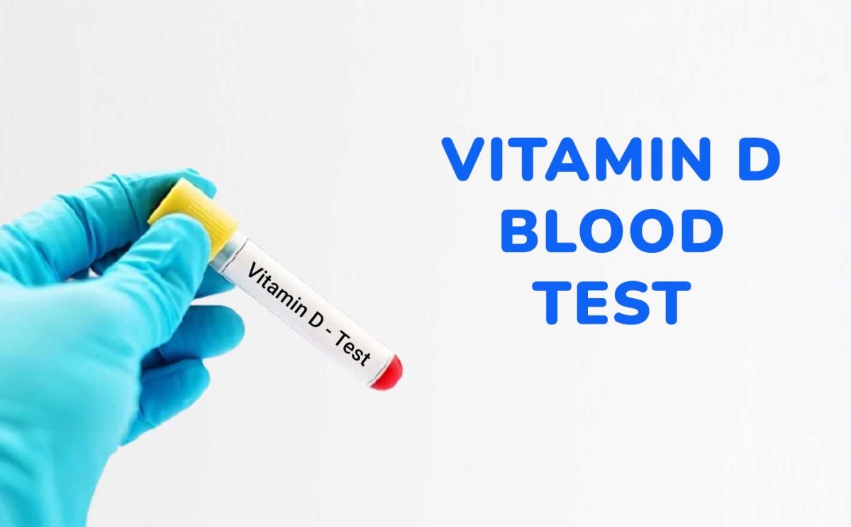 Vitamin D Blood Test LifeCare Diagnostic Medical Centre