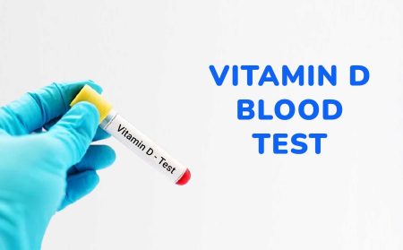 vitamin d blood test
