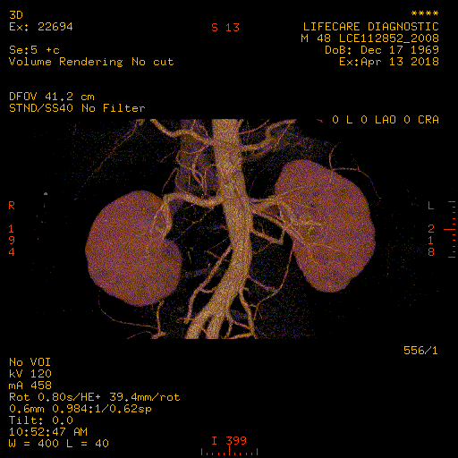 CT Scan-Renal