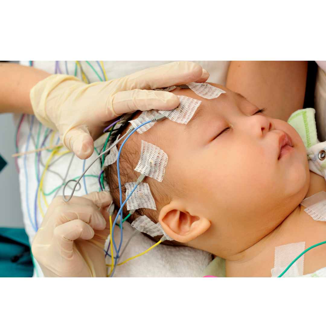 EEG