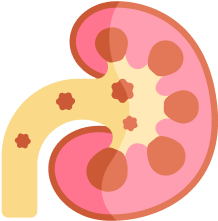 Kidney Health: Sustaining Life’s Hidden Pillars