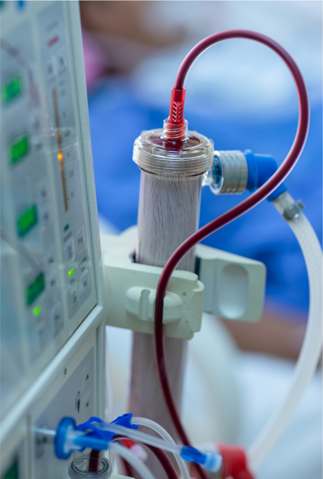 Kidney Health: Sustaining Life’s Hidden Pillars