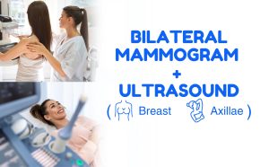 Bilateral Ultrasound Breasts & Axillae with Doctor Consultation