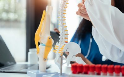 serious doctors team are analyzing fracture knee model showing the process of osteoarthritis patients and knee arthroplasty.