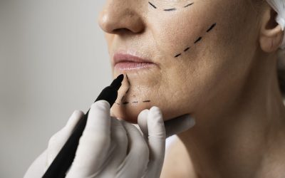 plastic surgery